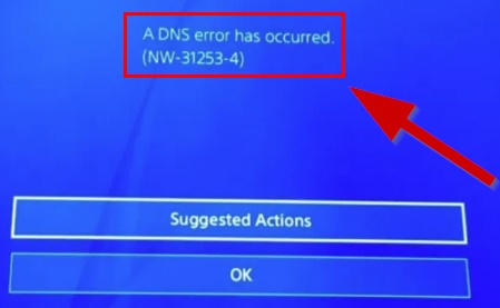 How To Fix DNS ERROR PS4